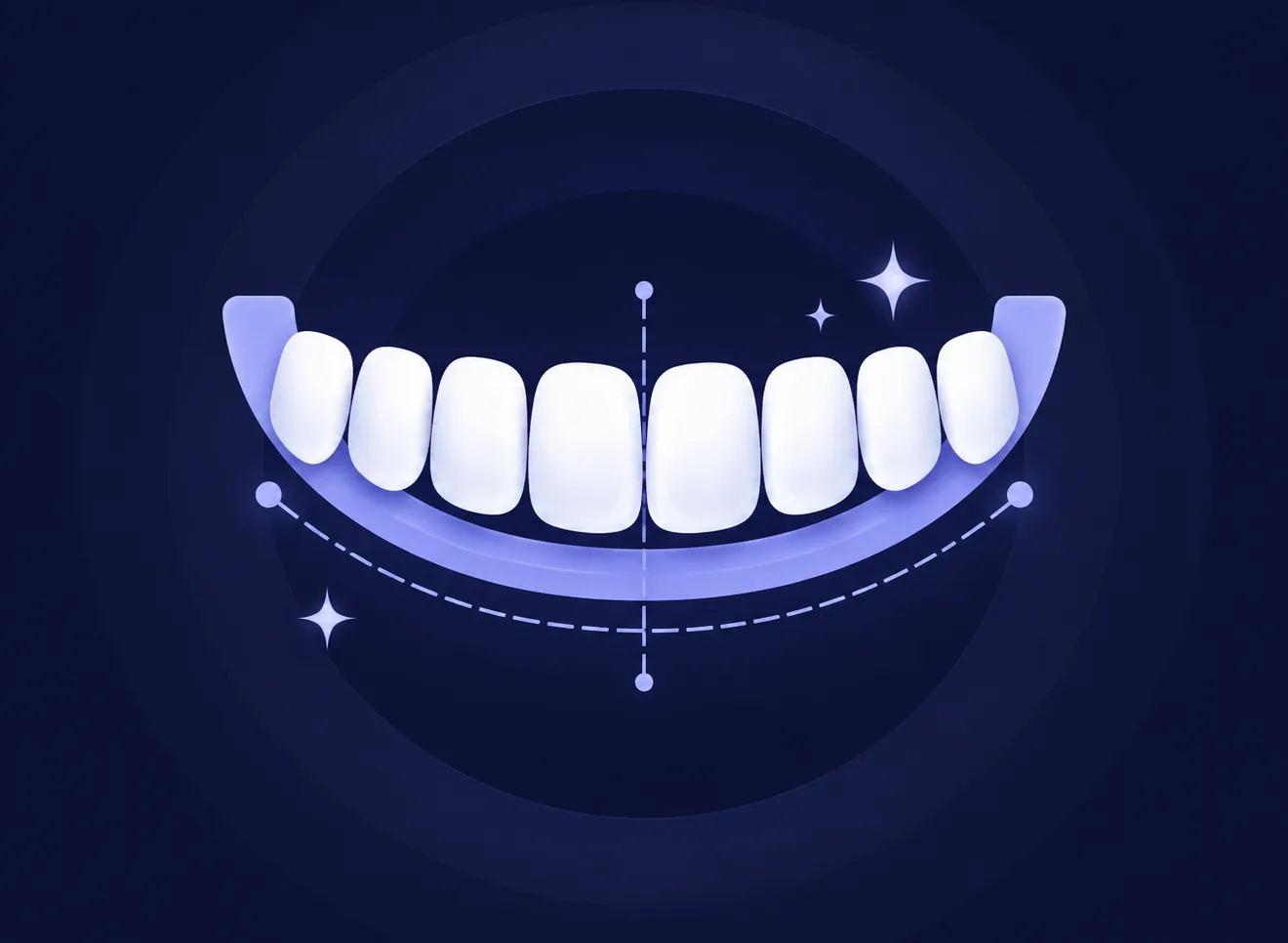 Illustration of a smile design with balanced, evenly shaped teeth