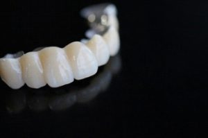 dental crown mouth reconstruction san francisco